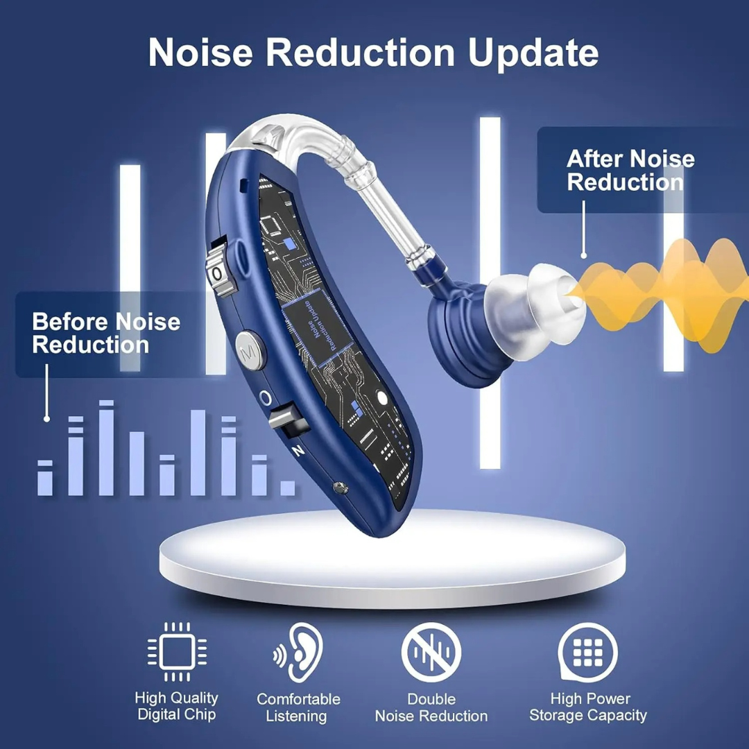 amplificador de audio